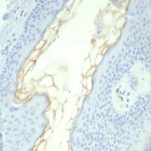 Formalin-fixed, paraffin-embedded human skin stained with Kallikrein 5 Mouse Monoclonal Antibody (KLK5/4761). HIER: Tris/EDTA, pH9.0, 45min. 2°C: HRP-polymer, 30min. DAB, 5min.