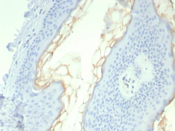 Formalin-fixed, paraffin-embedded human skin stained with Kallikrein 5 Mouse Monoclonal Antibody (KLK5/4761). HIER: Tris/EDTA, pH9.0, 45min. 2°C: HRP-polymer, 30min. DAB, 5min.