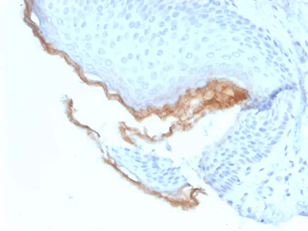 Formalin-fixed, paraffin-embedded human skin stained with  Kallikrein 5 Mouse Monoclonal Antibody (KLK5/3844).
