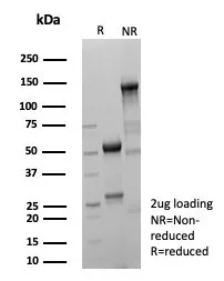 SDS-PAGE Analysis of Purified GATA-3 Recombinant Rabbit Monoclonal Antibody (rGATA3/9133). Confirmation of Purity and Integrity of Antibody.