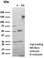 SDS-PAGE Analysis of Purified GATA-3 Recombinant Rabbit Monoclonal Antibody (GATA3/7686R). Confirmation of Purity and Integrity of Antibody.