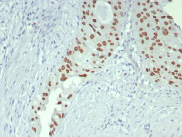Formalin-fixed, paraffin-embedded human bladder stained with GATA-3 Recombinant Rabbit Monoclonal Antibody (GATA3/7686R). HIER: Tris/EDTA, pH9.0, 45min. 2°C: HRP-polymer, 30min. DAB, 5min.