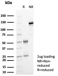 SDS-PAGE Analysis  Purified GBP1 Mouse Monoclonal Antibody (GBP1/7617). Confirmation of Purity and Integrity of Antibody.