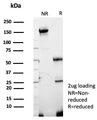 SDS-PAGE Analysis  Purified GBP1 Mouse Monoclonal Antibody (GBP1/7618). Confirmation of Purity and Integrity of Antibody.