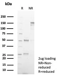 SDS-PAGE Analysis of Purified GBX2 Mouse Monoclonal Antibody (GBX2/7235). Confirmation of Purity and Integrity of Antibody.