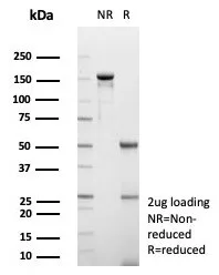 SDS-PAGE Analysis of Purified GCHFR Mouse Monoclonal Antibody (GCHFR/7732). Confirmation of Purity and Integrity of Antibody.