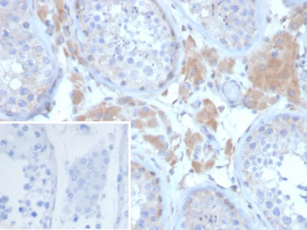 Formalin-fixed, paraffin-embedded human ovary stained with GDF9 Mouse Monoclonal Antibody (GDF9/6458). Inset: PBS instead of primary antibody; secondary only negative control.