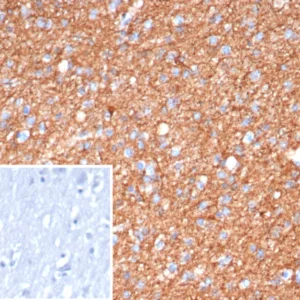 Formalin-fixed, paraffin-embedded human brain stained with GFAP Mouse Monoclonal Antibody (GFAP/6874). Inset: PBS instead of primary antibody; secondary only negative control.