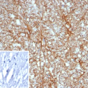 Formalin-fixed, paraffin-embedded human brain stained with GFAP Mouse Monoclonal Antibody (GFAP/6876). Inset: PBS instead of primary antibody; secondary only negative control.