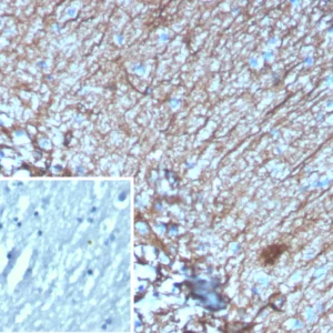 Formalin-fixed, paraffin-embedded human brain stained with GFAP Mouse Monoclonal Antibody (GFAP/6878). Inset: PBS instead of primary antibody; secondary only negative control.