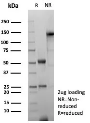 SDS-PAGE Analysis of Purified GFAP Recombinant Mouse Monoclonal Antibody (rGFAP/8685). Confirmation of Integrity and Purity of Antibody.