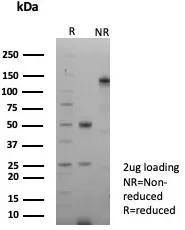 SDS-PAGE Analysis of Purified GFAP Recombinant Mouse Monoclonal Antibody (rGFAP/9150). Confirmation of Integrity and Purity of Antibody.