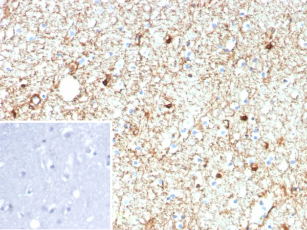 GFAP Antibody [rGFAP/9150] staining on human cerebellum stained with DAB chromogen. Left inset - negative tissue control.