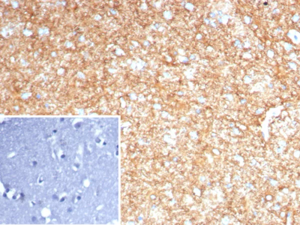 Formalin-fixed, paraffin-embedded human brain stained with GFAP Recombinant Rabbit Monoclonal Antibody (GFAP/8255R). Inset: PBS instead of primary antibody; secondary only negative control.
