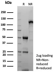 SDS-PAGE Analysis of Purified GFAP Recombinant Rabbit Monoclonal Antibody (GFAP/8615R). Confirmation of Purity and Integrity of Antibody.