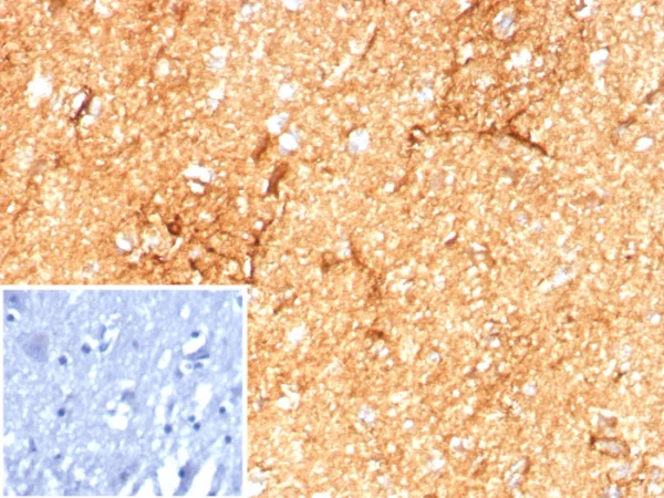 Formalin-fixed, paraffin-embedded human brain stained with GFAP Recombinant Rabbit Monoclonal Antibody (GFAP/8615R). Inset: PBS instead of primary antibody; secondary only negative control.