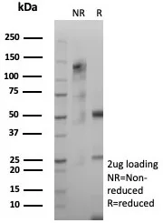 SDS-PAGE Analysis of Purified GFAP Recombinant Rabbit Monoclonal Antibody (GFAP/8616R). Confirmation of Purity and Integrity of Antibody.
