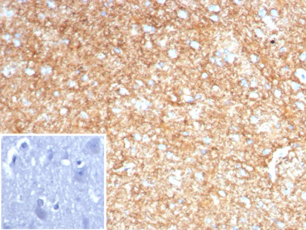 Formalin-fixed, paraffin-embedded human brain stained with GFAP Recombinant Rabbit Monoclonal Antibody (GFAP/8616R). Inset: PBS instead of primary antibody; secondary only negative control.