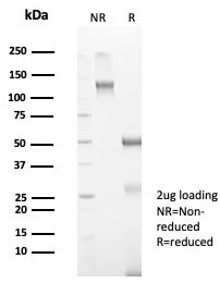 SDS-PAGE Analysis of Purified Anti-Mullerian Hormone Mouse Monoclonal Antibody (AMH/7354). Confirmation of Purity and Integrity of Antibody.