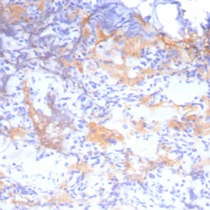 Formalin-fixed, paraffin-embedded human pituitary stained with Growth Hormone Recombinant Rabbit Monoclonal Antibody (GH/8215R). HIER: Tris/EDTA, pH9.0, 45min. 2: HRP-polymer, 30min. DAB, 5min.