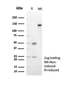 SDS-PAGE Analysis of Purified CD57 Mouse Monoclonal Antibody (NK1/7565). Confirmation of Purity and Integrity of Antibody.