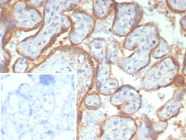 Formalin-fixed, paraffin-embedded human placenta stained with Glypican-3 Recombinant Rabbit Monoclonal Antibody (GPC3/7991R). Inset: PBS instead of primary antibody; secondary only negative control.