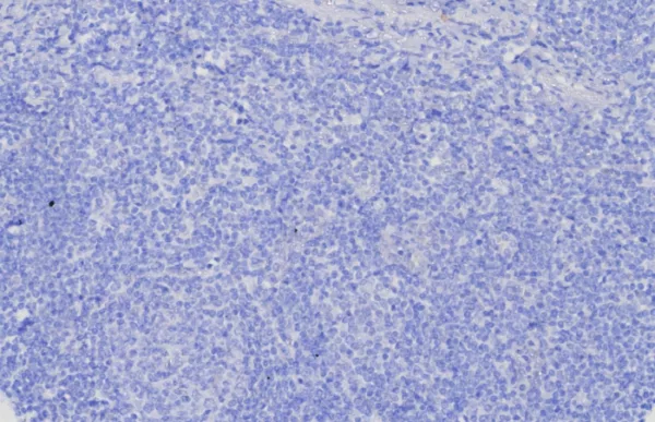 IHC analysis of formalin-fixed, paraffin-embedded human brain. Negative tissue control using GPC3/8127R at 2ug/ml in PBS for 30min RT.  HIER: Tris/EDTA, pH9.0, 45min. 2: HRP-polymer, 30min. DAB, 5min.