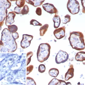 Formalin-fixed, paraffin-embedded human placenta stained with Glypican-3 Recombinant Rabbit Monoclonal Antibody (GPC3/8148R). Inset: PBS instead of primary antibody; secondary only negative control.