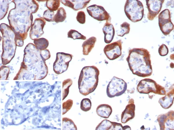 Formalin-fixed, paraffin-embedded human placenta stained with Glypican-3 Recombinant Rabbit Monoclonal Antibody (GPC3/8148R). Inset: PBS instead of primary antibody; secondary only negative control.