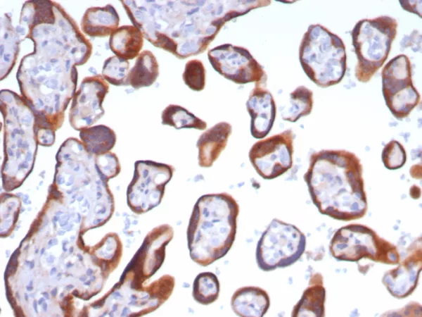 Formalin-fixed, paraffin-embedded human placenta stained with Glypican-3 Recombinant Rabbit Monoclonal Antibody (GPC3/8148R). HIER: Tris/EDTA, pH9.0, 45min. 2: HRP-polymer, 30min. DAB, 5min.