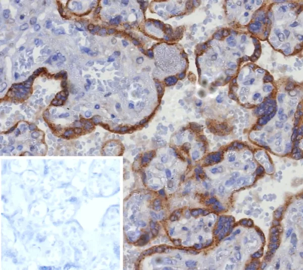 Formalin-fixed, paraffin-embedded human placenta stained with Glypican-3 Recombinant Rabbit Monoclonal Antibody (GPC3/8363R). Inset: PBS instead of primary antibody; secondary only negative control.