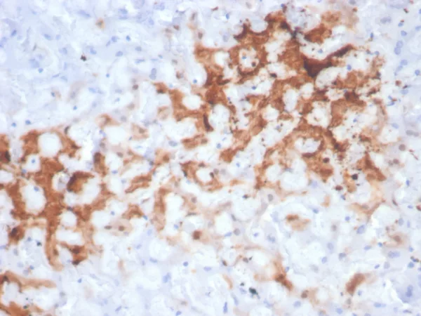 Formalin-fixed, paraffin-embedded dog liver stained with Glutamine Synthetase Mouse Monoclonal Antibody (GLUL/6601). HIER: Tris/EDTA, pH9.0, 45min. 2°C: HRP-polymer, 30min. DAB, 5min.