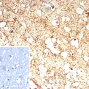 Formalin-fixed, paraffin-embedded human brain stained with GLUL Recombinant Mouse Monoclonal Antibody (rGLUL/8621). Inset: PBS instead of primary antibody; secondary only negative control.