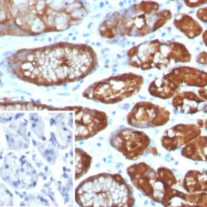 Formalin-fixed, paraffin-embedded human brain stained with GLUL Recombinant Rabbit Monoclonal Antibody (GLUL/8256R). Inset: PBS instead of primary antibody; secondary only negative control.