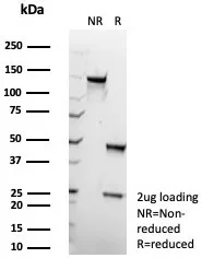 SDS-PAGE Analysis of Purified GLUL Recombinant Rabbit Monoclonal Antibody (GLUL/8517R). Confirmation of Purity and Integrity of Antibody.