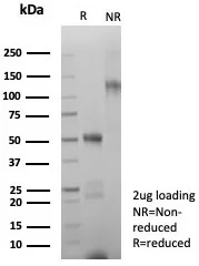 SDS-PAGE Analysis of Purified GLUL Recombinant Rabbit Monoclonal Antibody (GLUL/8619R). Confirmation of Purity and Integrity of Antibody.