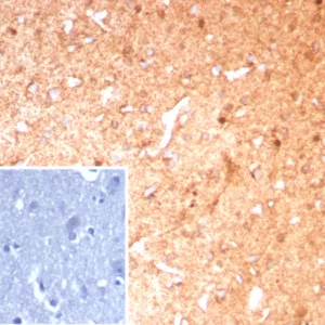 Formalin-fixed, paraffin-embedded human brain stained with GLUL Recombinant Rabbit Monoclonal Antibody (GLUL/8889R). Inset: PBS instead of primary antibody; secondary only negative control.