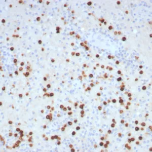 Formalin-fixed, paraffin-embedded human brain stained with GLUL Recombinant Rabbit Monoclonal Antibody (GLUL/8996R). HIER: Tris/EDTA, pH9.0, 45min. 2°C: HRP-polymer, 30min. DAB, 5min.