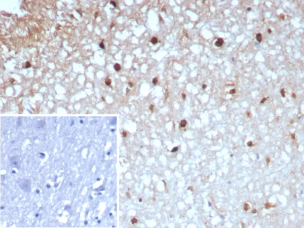 Formalin-fixed, paraffin-embedded human brain stained with GLUL Recombinant Rabbit Monoclonal Antibody (GLUL/8996R). Inset: PBS instead of primary antibody; secondary only negative control.