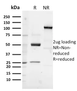 SDS-PAGE Analysis of Purified GP2 Recombinant Rabbit Monoclonal Antibody (GP2/3133R). Confirmation of Purity and Integrity of Antibody.