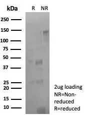 SDS-PAGE Analysis of Purified PD-L1 Recombinant Mouse Monoclonal Antibody (rPDL1/8825). Confirmation of Purity and Integrity of Antibody.