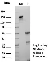 SDS-PAGE Analysis of Purified PD-L1 Recombinant Rabbit Monoclonal Antibody (PDL1/8408R). Confirmation of Purity and Integrity of Antibody.