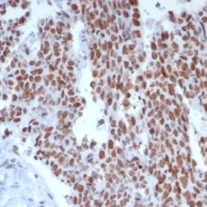 Formalin-fixed, paraffin-embedded human small intestine stained with MSH6 Recombinant Mouse Monoclonal Antibody (rMSH6/8181). HIER: Tris/EDTA, pH9.0, 45min. 2°C: HRP-polymer, 30min. DAB, 5min.