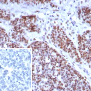 Formalin-fixed, paraffin-embedded human small intestine stained with MSH6 Recombinant Mouse Monoclonal Antibody (rMSH6/8337). Inset: PBS instead of primary antibody; secondary only negative control.