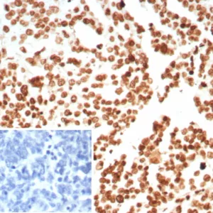 Recombinant Histone H1 (Pan Nuclear Marker) Antibody