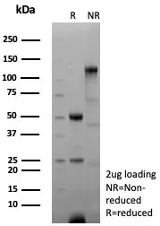 SDS-PAGE Analysis of Purified ANXA1 Recombinant Mouse Monoclonal Antibody (rANXA1/6451). Confirmation of Purity and Integrity of Antibody.