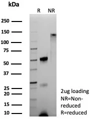 SDS-PAGE Analysis of Purified HBA2 Recombinant Rabbit Monoclonal Antibody (HBA/9193R). Confirmation of Purity and Integrity of Antibody.