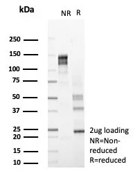 SDS-PAGE Analysis of Purified HEXB Mouse Monoclonal Antibody (HEXB/7762). Confirmation of Purity and Integrity of Antibody.