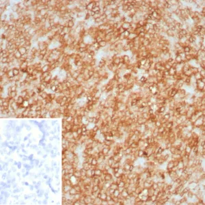 Formalin-fixed, paraffin-embedded human tonsil stained with HLA-DR Recombinant Mouse Monoclonal Antibody (rHLA-DRA/8285). Inset: PBS instead of primary antibody; secondary only negative control.