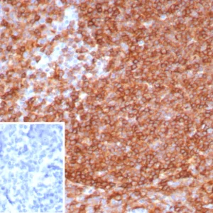Formalin-fixed, paraffin-embedded human tonsil stained with HLA-DR Recombinant Rabbit Monoclonal Antibody (HLA-DRA/8287R). Inset: PBS instead of primary antibody; secondary only negative control